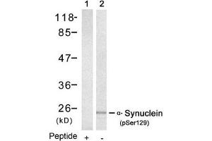 Western blot analysis of extracts from mouse brain tissue using a-Synuclein(Phospho-Ser129) Antibody(Lane 2) and the same antibody preincubated with blocking peptide(Lane1). (SNCA antibody  (pSer129))