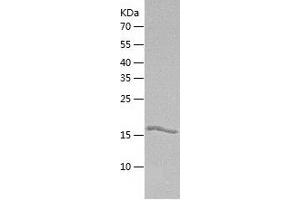 Western Blotting (WB) image for Gastrokine 1 (GKN1) (AA 1-199) protein (His tag) (ABIN7289032) (Gastrokine 1 Protein (GKN1) (AA 1-199) (His tag))