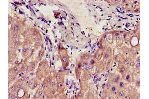 Immunohistochemistry of paraffin-embedded human liver tissue using ABIN7142182 at dilution of 1:100