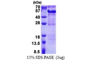 SDS-PAGE (SDS) image for Debranching Enzyme Homolog 1 (DBR1) (AA 228-544) protein (His tag) (ABIN5853256) (DBR1 Protein (AA 228-544) (His tag))