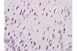 Paraformaldehyde-fixed, paraffin embedded rat brain tissue, Antigen retrieval by boiling in sodium citrate buffer(pH6) for 15min, Block endogenous peroxidase by 3% hydrogen peroxide for 30 minutes, Blocking buffer (normal goat serum) at 37°C for 20min, Antibody incubation with Rabbit Anti-MYCBP2 Polyclonal Antibody, Unconjugated  at 1:400 overnight at 4°C, followed by a conjugated secondary and DAB staining (MYCBP2 antibody  (AA 60-100))