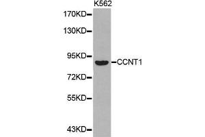 Western blot analysis of extracts of K562 cell lines, using CCNT1 antibody. (Cyclin T1 antibody  (AA 220-320))