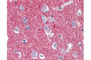 SLC25A28 antibody was used for immunohistochemistry at a concentration of 4-8 ug/ml. (SLC25A28 antibody  (C-Term))