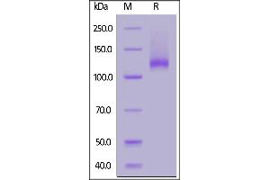 SDS-PAGE (SDS) image for Neuropilin 1 (NRP1) (AA 22-856) (Active) protein (His tag) (ABIN6992419)