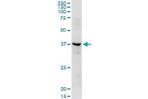ADH1C MaxPab rabbit polyclonal antibody. (ADH1C antibody  (AA 1-375))