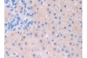 Used in DAB staining on fromalin fixed paraffin- embedded stomach cancer tissue (FIL1d antibody  (AA 12-151))