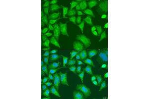 Immunofluorescence analysis of U2OS cells using SQSTM1 antibody. (SQSTM1 antibody  (AA 1-440))