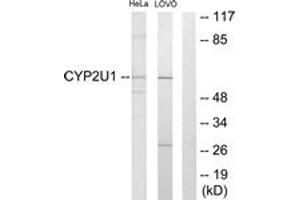 Western blot analysis of extracts from HeLa/Lovo cells, using Cytochrome P450 2U1 Antibody. (CYP2U1 antibody  (AA 281-330))