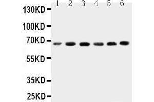 Anti-CETP antibody, Western blotting Lane 1: HELA Cell Lysate Lane 2: COLO320 Cell Lysate Lane 3:  Cell Lysate Lane 4: JURKAT Cell Lysate Lane 5: RAJI Cell Lysate Lane 6: MCF-7 Cell Lysate