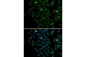 Immunofluorescence analysis of MCF-7 cells using LMO4 antibody (ABIN4904242). (LMO4 antibody)