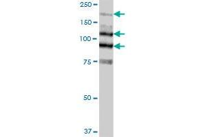 MYLK MaxPab polyclonal antibody. (MYLK antibody  (AA 1-992))