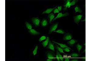 Image no. 1 for anti-Neural Wiskott-Aldrich syndrome protein (WASL) (AA 97-185) antibody (ABIN598590) (Neural Wiskott-Aldrich syndrome protein (WASL) (AA 97-185) antibody)