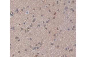 Used in DAB staining on fromalin fixed paraffin- embedded brain tissue (CABIN1 antibody  (AA 23-288))