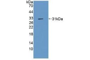 Detection of Recombinant CFLAR, Rat using Polyclonal Antibody to CASP8 And FADD Like Apoptosis Regulator (CFLAR) (FLIP antibody  (AA 43-281))