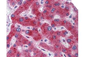 Immunohistochemistry (IHC) image for anti-Methylenetetrahydrofolate Dehydrogenase (NADP+ Dependent) 1, Methenyltetrahydrofolate Cyclohydrolase, Formyltetrahydrofolate Synthetase (MTHFD1) (N-Term) antibody (ABIN2782514)