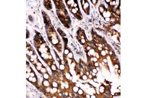 Anti-Caspase-6(P18) antibody,  IHC(P) IHC(P): Rat Intestine Tissue (Caspase 6 antibody  (N-Term))