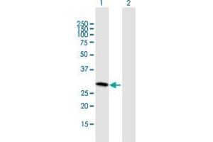 Western Blot analysis of SLC25A27 expression in transfected 293T cell line by SLC25A27 MaxPab polyclonal antibody. (SLC25A27 antibody  (AA 1-245))