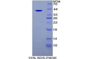 SDS-PAGE analysis of Human Mucin 6 Protein. (MUC6 Protein)