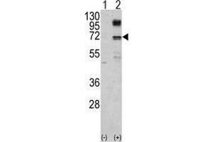 Western blot analysis of NFE2L2 (arrow) using NFE2L2 Antibody .