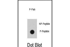 Dot blot analysis of anti-EGFR B1 Phospho-specific Pab (ABIN389891 and ABIN2839735) on nitrocellulose membrane.