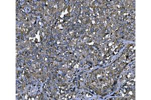 IHC analysis of ENAH/MENA using anti-ENAH/MENA antibody (ABIN7601316). (ENAH antibody  (AA 32-551))