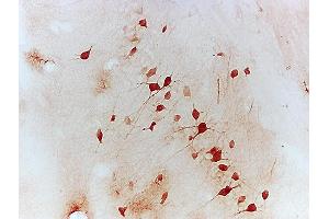 Mouse Hippocampal tissue labeled with Anti-NFATc1/NFAT2 Polyclonal Antibody, Unconjugated (ABIN686257) followed by conjugation to the secondary antibody (NFATC1 antibody  (AA 601-716))
