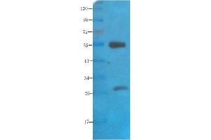 Western Blot using anti-polysialic acid antibody   Rat brain lysate was resolved on a 10% SDS PAGE gel and blots probed with  at 2 µg/ml before being detected by a secondary antibody. (Recombinant Polysialic Acid antibody)