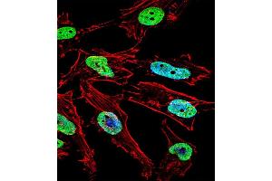 Fluorescent confocal image of Hela cell stained with NKX1-1 Antibody (Center) (ABIN655858 and ABIN2845265). (NKX1-1 antibody  (AA 230-258))