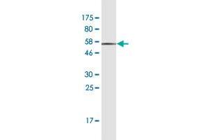Western Blot detection against Immunogen (49. (CLTA antibody  (AA 1-218))