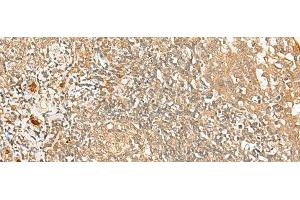 Immunohistochemistry of paraffin-embedded Human tonsil tissue using PROKR1 Polyclonal Antibody at dilution of 1:40(x200) (Prokineticin Receptor 1 antibody)