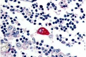 Human Macrophage (formalin-fixed, paraffin-embedded) stained with EMR3 antibody ABIN213514 at 2. (EMR3 antibody  (C-Term))