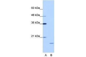 ISG20 antibody used at 1. (ISG20 antibody  (N-Term))