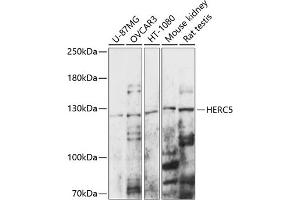 Western blot analysis of extracts of various cell lines, using HERC5 antibody (ABIN7267596) at 1:1000 dilution. (HERC5 antibody  (AA 360-700))