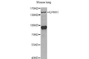 Western blot analysis of extracts of mouse lung, using EPHA1 antibody (ABIN6290349) at 1:1000 dilution.