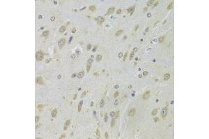 Immunohistochemistry of paraffin-embedded mouse brain using DHRS9 Antibody (ABIN5973740) at dilution of 1/100 (40x lens).