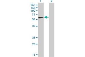 Western Blot analysis of IGHA2 expression in transfected 293T cell line by IGHA2 MaxPab polyclonal antibody. (IGHA2 antibody  (AA 1-477))