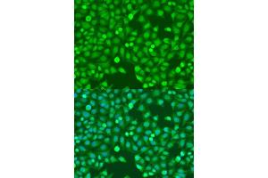 Immunofluorescence analysis of U2OS cells using MEF2A antibody (ABIN6134844, ABIN6143711, ABIN6143714 and ABIN6223904) at dilution of 1:100. (MEF2A antibody)