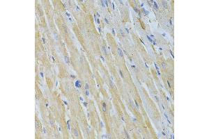 Immunohistochemistry of paraffin-embedded rat heart using NME1 Antibody. (NME1 antibody  (C-Term))
