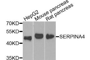 Western blot analysis of extracts of various cells, using SERPINA4 antibody. (SERPINA4 antibody)