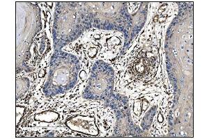 IHC analysis of TAGLN/Transgelin using anti-TAGLN/Transgelin antibody (ABIN7600099). (Transgelin antibody  (AA 15-170))