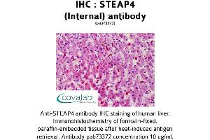 Image no. 1 for anti-STEAP Family Member 4 (STEAP4) (Internal Region) antibody (ABIN1739713) (STEAP4 antibody  (Internal Region))