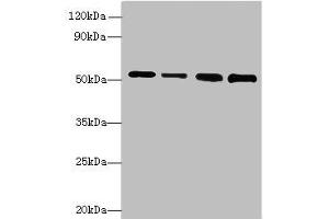 Western blot All lanes: STK38L antibody at 6 μg/mL Lane 1: A375 whole cell lysate Lane 2: HepG2 whole cell lysate Lane 3: A549 whole cell lysate Lane 4: HCT116 whole cell lysate Secondary Goat polyclonal to rabbit IgG at 1/10000 dilution Predicted band size: 55, 44 kDa Observed band size: 55 kDa (STK38L antibody  (AA 212-464))