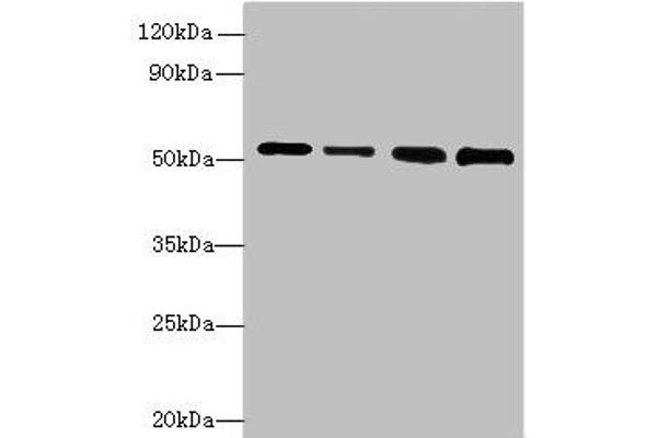 STK38L Antikörper  (AA 212-464)