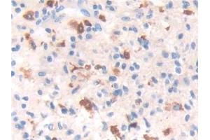 Immunohistochemistry (IHC) image for anti-Interferon, gamma-Inducible Protein 30 (IFI30) (AA 1-250) antibody (ABIN7435856)