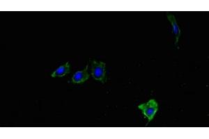 Immunofluorescent analysis of Hela cells using ABIN7176901 at dilution of 1:100 and Alexa Fluor 488-congugated AffiniPure Goat Anti-Rabbit IgG(H+L) (LYPLA1 antibody  (AA 1-230))