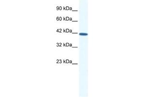 Western Blotting (WB) image for anti-SRY (Sex Determining Region Y)-Box 11 (SOX11) antibody (ABIN2460694) (SOX11 antibody)
