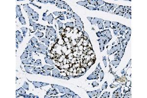 IHC analysis of Transketolase/TKT using anti-Transketolase/TKT antibody (ABIN7598958). (TKT antibody  (AA 1-116))