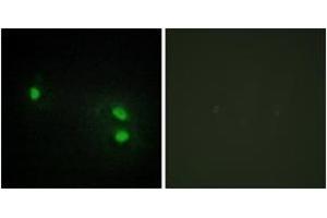 Immunofluorescence analysis of HeLa cells, using Histone H2B Antibody. (Histone H2B antibody  (AA 1-50))