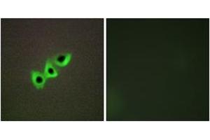 Immunofluorescence analysis of A549 cells, using RHG07 Antibody. (DLC1 antibody  (AA 61-110))