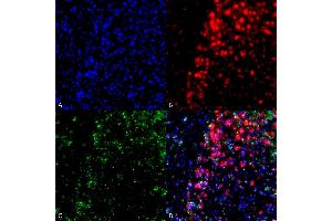 Immunocytochemistry/Immunofluorescence analysis using Mouse Anti-Alpha Synuclein Monoclonal Antibody, Clone 3F8 (ABIN5564099). (SNCA antibody  (APC))
